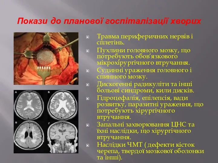 Покази до планової госпіталізації хворих Травма периферичних нервів і сплетінь. Пухлини головного