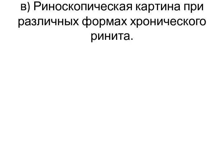 в) Риноскопическая картина при различных формах хронического ринита.