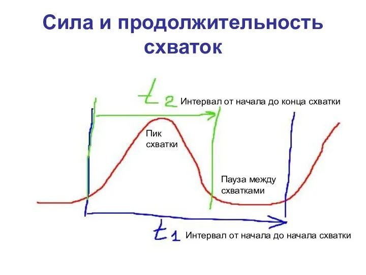 Сила и продолжительность схваток Пик схватки Пауза между схватками Интервал от начала