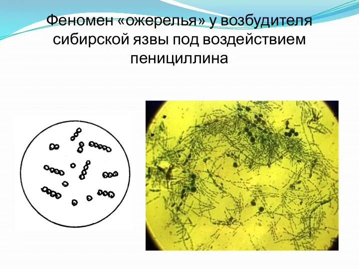 Феномен «ожерелья» у возбудителя сибирской язвы под воздействием пенициллина