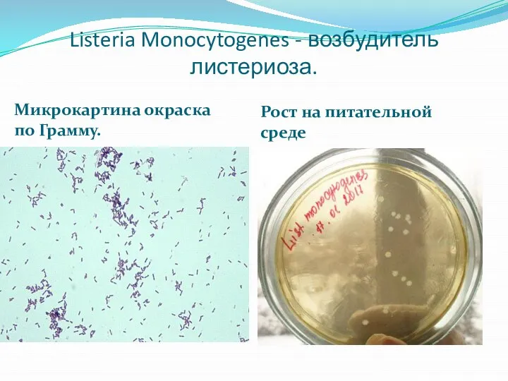 Listeria Monocytogenes - возбудитель листериоза. Микрокартина окраска по Грамму. Рост на питательной среде