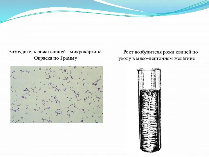 Возбудитель рожи свиней - микрокартина. Окраска по Грамму Рост возбудителя рожи свиней