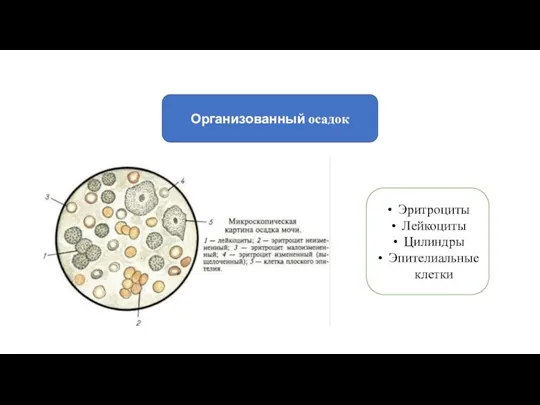 Организованный осадок Эритроциты Лейкоциты Цилиндры Эпителиальные клетки