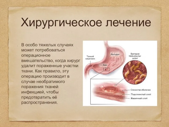 Хирургическое лечение В особо тяжелых случаях может потребоваться операционное вмешательство, когда хирург