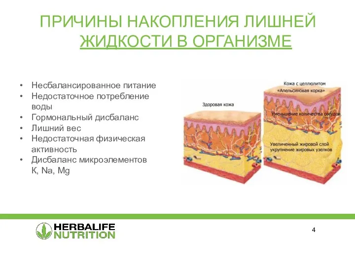 ПРИЧИНЫ НАКОПЛЕНИЯ ЛИШНЕЙ ЖИДКОСТИ В ОРГАНИЗМЕ Несбалансированное питание Недостаточное потребление воды Гормональный