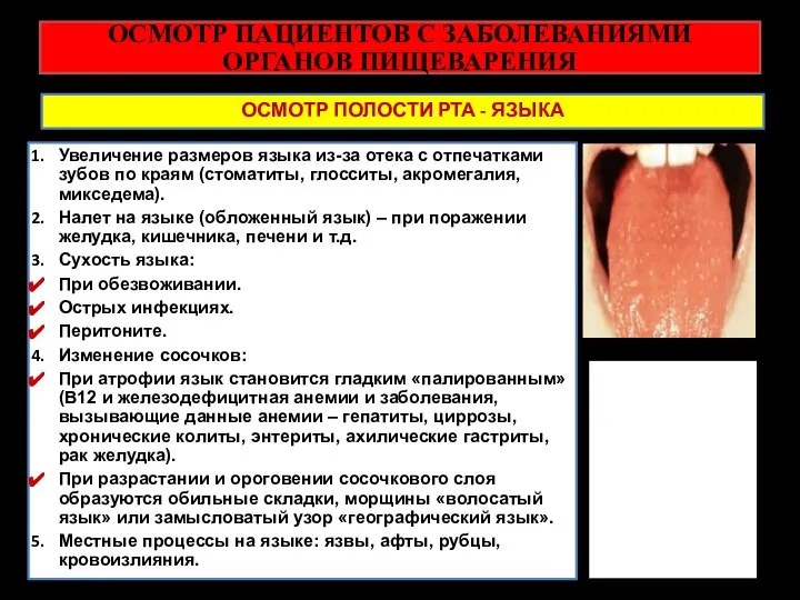 ОСМОТР ПАЦИЕНТОВ С ЗАБОЛЕВАНИЯМИ ОРГАНОВ ПИЩЕВАРЕНИЯ ОСМОТР ПОЛОСТИ РТА - ЯЗЫКА Увеличение