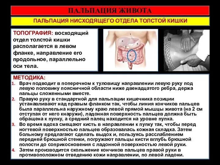 ПАЛЬПАЦИЯ ЖИВОТА ПАЛЬПАЦИЯ НИСХОДЯЩЕГО ОТДЕЛА ТОЛСТОЙ КИШКИ ТОПОГРАФИЯ: восходящий отдел толстой кишки