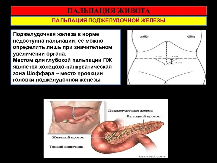 ПАЛЬПАЦИЯ ЖИВОТА ПАЛЬПАЦИЯ ПОДЖЕЛУДОЧНОЙ ЖЕЛЕЗЫ Поджелудочная железа в норме недоступна пальпации, ее