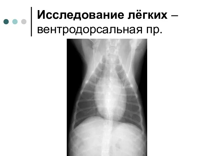 Исследование лёгких – вентродорсальная пр.