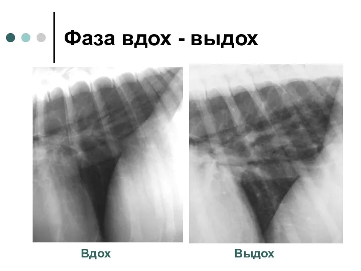 Фаза вдох - выдох Вдох Выдох