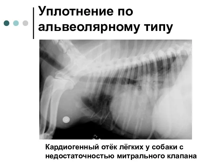 Уплотнение по альвеолярному типу Кардиогенный отёк лёгких у собаки с недостаточностью митрального клапана