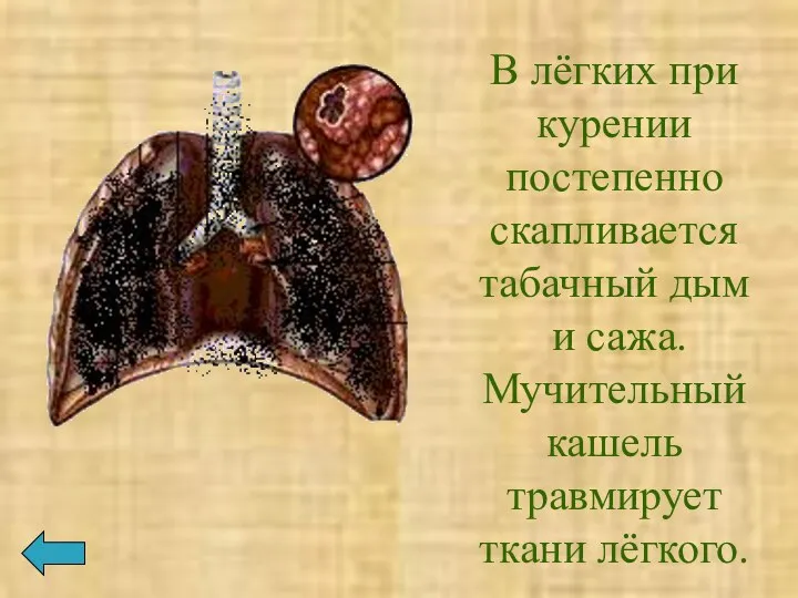 В лёгких при курении постепенно скапливается табачный дым и сажа. Мучительный кашель травмирует ткани лёгкого.