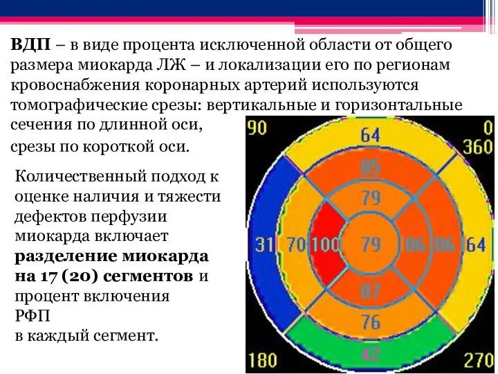 ВДП – в виде процента исключенной области от общего размера миокарда ЛЖ