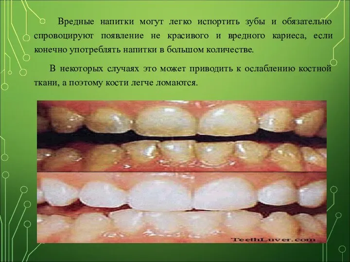 Вредные напитки могут легко испортить зубы и обязательно спровоцируют появление не красивого