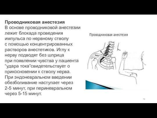 Проводниковая анестезия В основе проводниковой анестезии лежит блокада проведения импульса по нервному