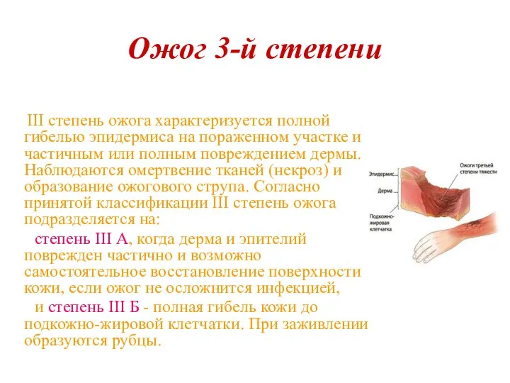 Ожог 3-й степени III степень ожога характеризуется полной гибелью эпидермиса на пораженном