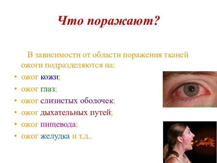 Что поражают? В зависимости от области поражения тканей ожоги подразделяются на: ожог