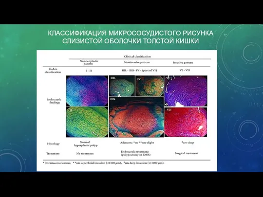 КЛАССИФИКАЦИЯ МИКРОСОСУДИСТОГО РИСУНКА СЛИЗИСТОЙ ОБОЛОЧКИ ТОЛСТОЙ КИШКИ