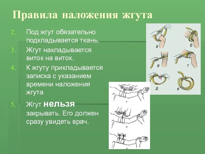 Правила наложения жгута Под жгут обязательно подкладывается ткань. Жгут накладывается виток на