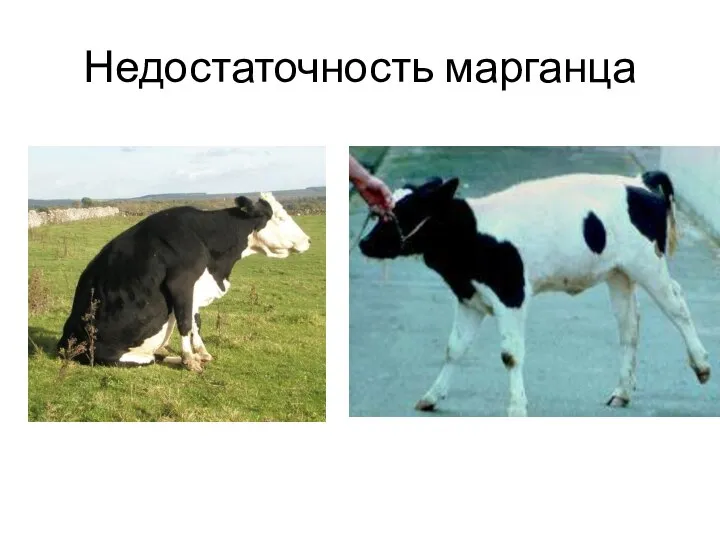 Недостаточность марганца