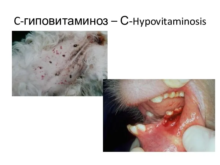 C-гиповитаминоз – С-Hypovitaminosis