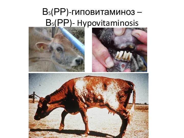 В5(РР)-гиповитаминоз – В5(РР)- Hypovitaminosis