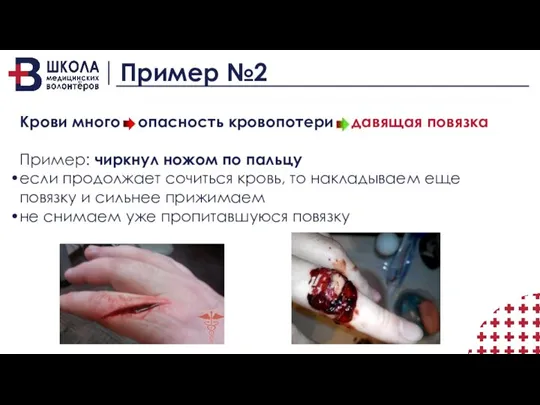 Пример №2 Крови много опасность кровопотери давящая повязка Пример: чиркнул ножом по