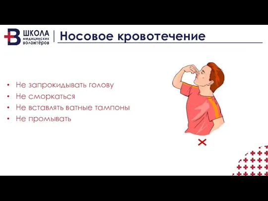 Носовое кровотечение Не запрокидывать голову Не сморкаться Не вставлять ватные тампоны Не промывать