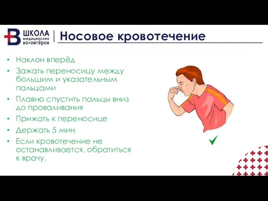 Носовое кровотечение Наклон вперёд Зажать переносицу между большим и указательным пальцами Плавно