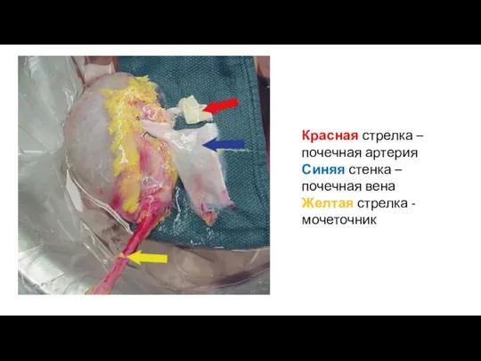 Красная стрелка – почечная артерия Синяя стенка – почечная вена Желтая стрелка - мочеточник