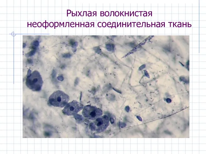 Рыхлая волокнистая неоформленная соединительная ткань