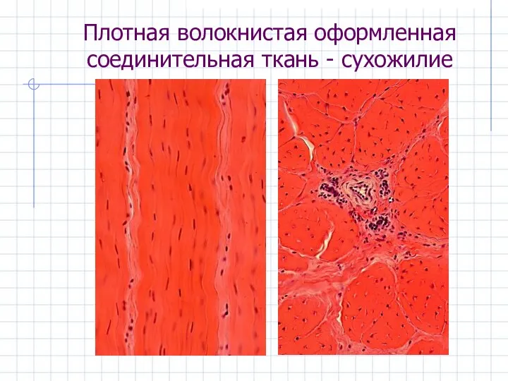 Плотная волокнистая оформленная соединительная ткань - сухожилие