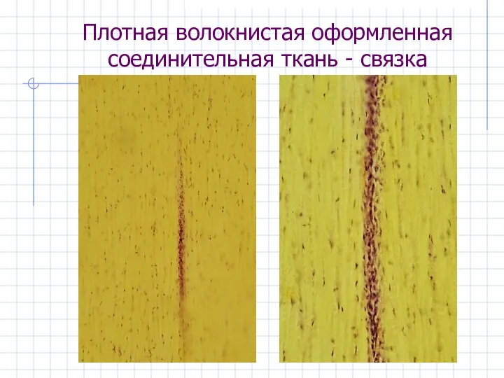 Плотная волокнистая оформленная соединительная ткань - связка