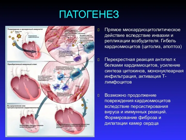 ПАТОГЕНЕЗ Прямое миокардиоцитолитическое действие вследствие инвазии и репликации возбудителя. Гибель кардиомиоцитов (цитолиз,