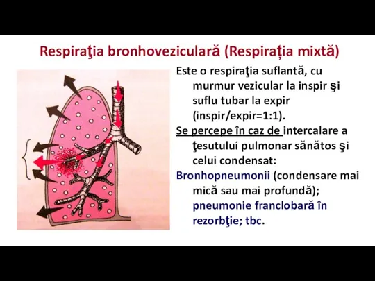 Respiraţia bronhoveziculară (Respirația mixtă) Este o respiraţia suflantă, cu murmur vezicular la