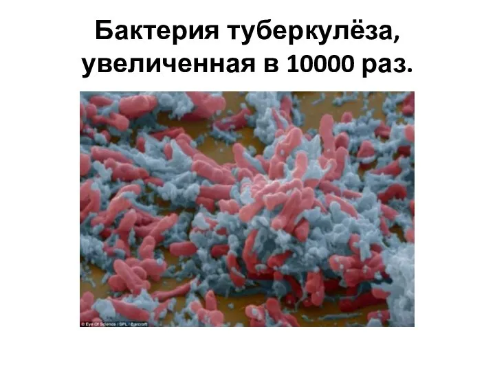 Бактерия туберкулёза, увеличенная в 10000 раз.