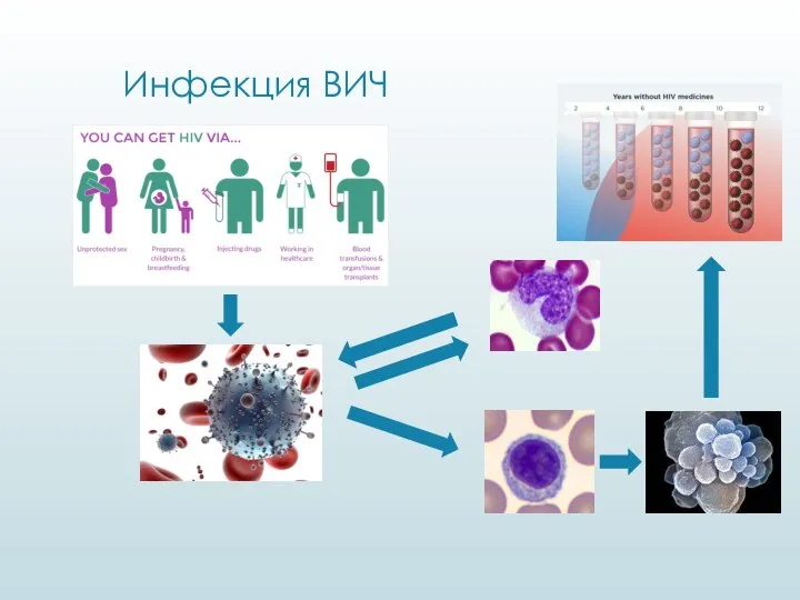 Инфекция ВИЧ