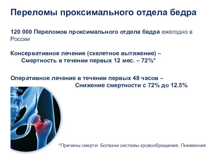 Переломы проксимального отдела бедра 120 000 Переломов проксимального отдела бедра ежегодно в