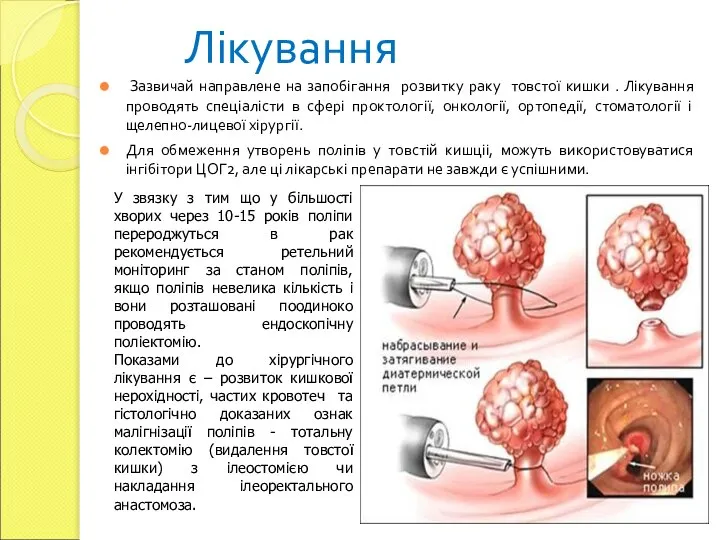 Лікування Зазвичай направлене на запобігання розвитку раку товстої кишки . Лікування проводять