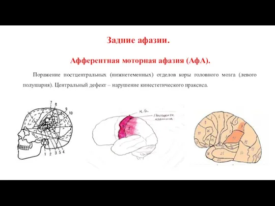 Задние афазии. Афферентная моторная афазия (АфА). Поражение постцентральных (нижнетеменных) отделов коры головного