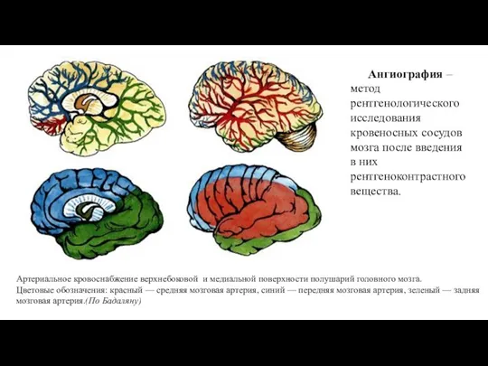 Артериальное кровоснабжение верхнебоковой и медиальной поверхности полушарий головного мозга. Цветовые обозначения: красный