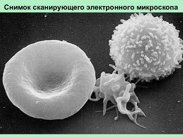 Снимок сканирующего электронного микроскопа