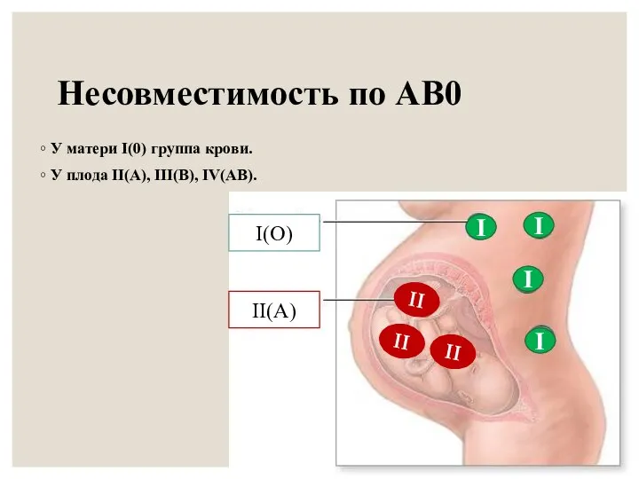 Несовместимость по АВ0 У матери I(0) группа крови. У плода II(А), III(В),