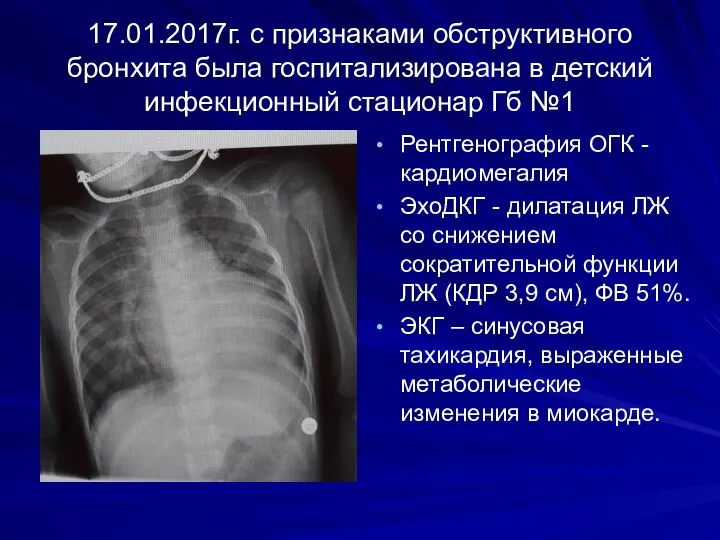 17.01.2017г. с признаками обструктивного бронхита была госпитализирована в детский инфекционный стационар Гб