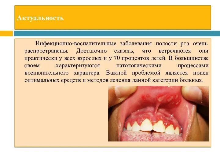 Актуальность Инфекционно-воспалительные заболевания полости рта очень распространены. Достаточно сказать, что встречаются они