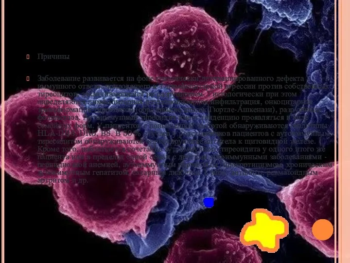 Причины Заболевание развивается на фоне генетически детерминированного дефекта иммунного ответа, приводящего к