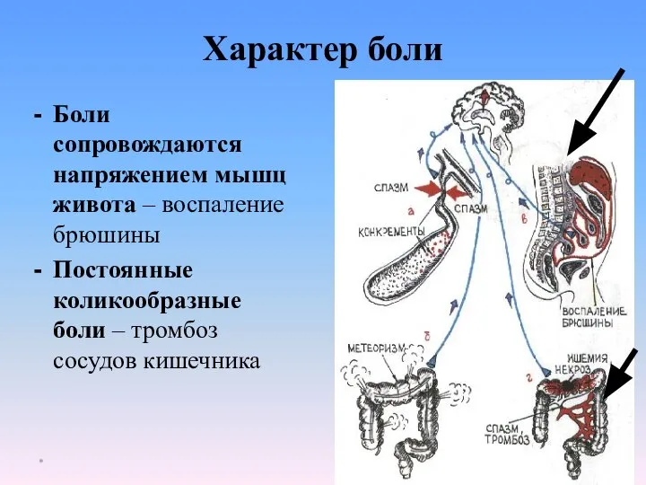 Характер боли Боли сопровождаются напряжением мышц живота – воспаление брюшины Постоянные коликообразные