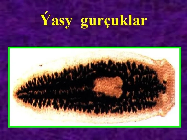 Ýasy gurçuklar