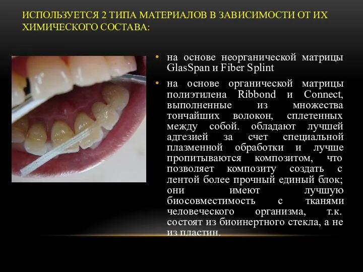 ИСПОЛЬЗУЕТСЯ 2 ТИПА МАТЕРИАЛОВ В ЗАВИСИМОСТИ ОТ ИХ ХИМИЧЕСКОГО СОСТАВА: на основе