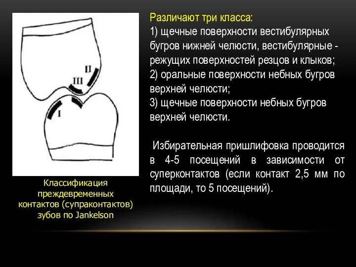 Различают три класса: 1) щечные поверхности вестибулярных бугров нижней челюсти, вестибулярные -